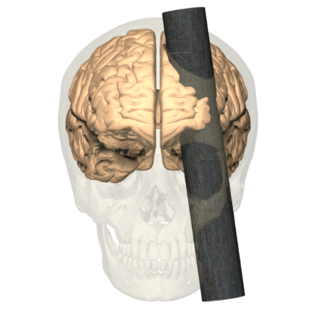 Hersenletsel Phineas Gage